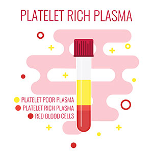 Platelet rich plasma diagram.